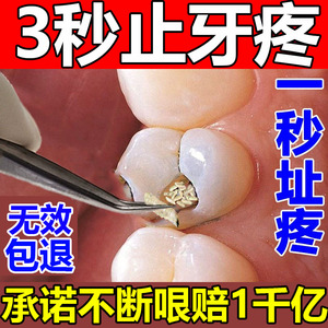 治牙疼牙痛止疼药速效杀死牙神经去牙疼牙痛立可停牙龈宁专用喷剂