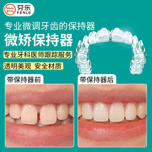 定制式反弹微调保持器定做隐形牙齿透明矫正牙套钢丝地包天龅牙凸