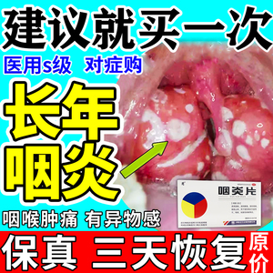 咽炎慢性咽喉炎专用咽干咽痒咳嗽咽喉肿痛发炎异物感特难受中药效