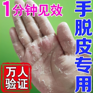 手脱皮严重专用治起皮干燥季节性儿童手脚上脱皮维生素手足抑菌膏
