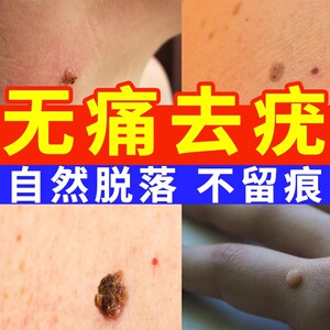 尖锐湿疣特效药专用膏去根男女性私处尖锐湿疣去除神器扁平疣去除膏一抹灵软膏日本疣瘊子药膏肛门丝状疣脖子小肉粒一抹无忧正品