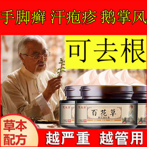 手癣膏真菌感染水泡脱皮湿疹止痒药膏干裂去根鹅掌风手脚癣汗疱疹