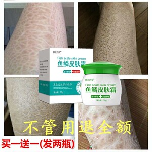 鱼鳞蛇皮霜治疗皮肤干燥皮屑病去鸡皮专用药小腿身体乳脱皮起皮