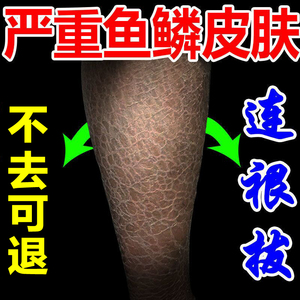 罗非鱼皮干
