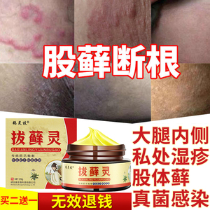 股藓大腿内侧真菌感染私处屁股治疗皮肤体癣湿疹止痒去根股癣药膏