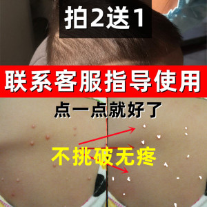 传染性软疣儿童病毒性软疣药膏去疣膏工具治疗水猴子去除水瘊子药