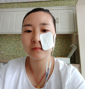 中频家用康复理疗仪面部面瘫理疗仪三叉神经针灸经络治疗仪热敷仪