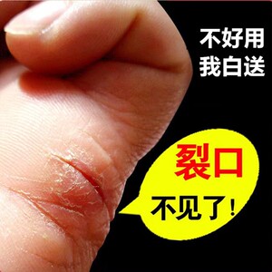 李氏百草治手裂的药膏开裂治疗手脱皮蜕皮鹅掌风脚干裂痒真菌感染