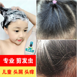 去卷发虫专业除吃发虫儿童去屑止痒女孩抗真菌除螨虫剪发虫洗发水