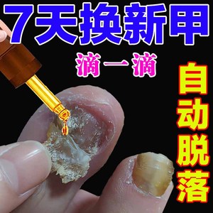 灰指甲根专用药膏亮甲软化脱甲脚气杀真菌液进口正品治包甲套日本