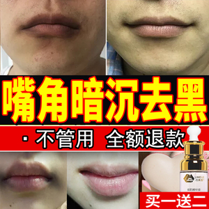 【唇周围黑色素】唇周围黑色素品牌,价格 - 阿里巴巴