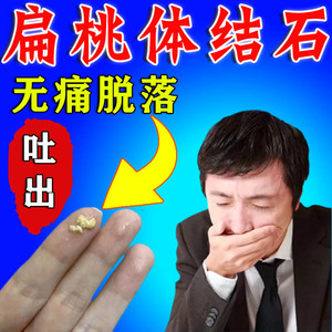 【正品保证】扁桃体结石去除工具专治咽喉异物感发炎肥肿口臭喷雾