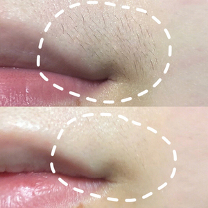 去除小胡子漂胡剂脱唇毛汗毛学生女士永久专用漂白剂胡须脱毛膏