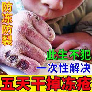 1976淘宝寒露冻疮膏修冻抑菌膏宝宝舒缓霜30g 婴幼深层修护1人付款38