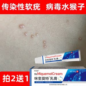 去传染性软疣儿童病毒性软疣膏水瘊子药膏去除扁平疣治疗水猴子药