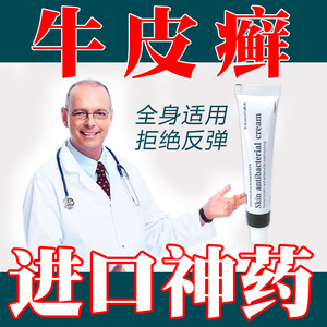 特效药去除顽固牛皮癣银屑藓病荨麻疹专治皮疹湿疹止痒外用药膏