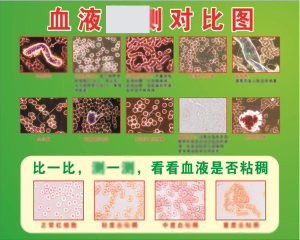 一滴血检测仪高清专业血液ct机专业血细胞挂图分析说明图解