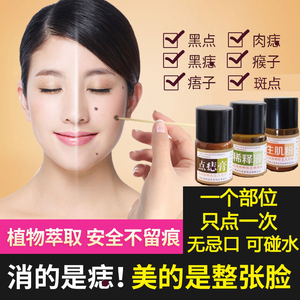 中药点痣膏无痕专用药水正品脸部祛痣液取去斑痣不留疤神器仪除灵