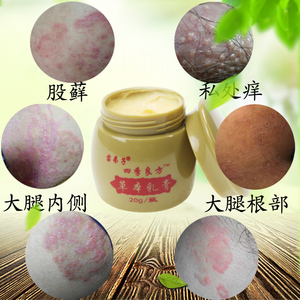 股藓膏男女大腿内侧成人阴囊肛门止痒膏私处护理消毒去痒湿清霜