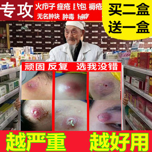 504人付款淘宝火疖子拔毒膏贴硬疙瘩浓包红肿痘痘坐板疮拔脓膏硬块