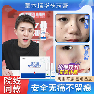 点痣的药膏去痣无痕正品脸部的取黑痣肉志去除膏美容院专用神器