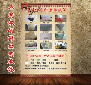沙棘排毒宣传海报不同体质排出的体液图片排酸挂画沙棘排毒墙贴