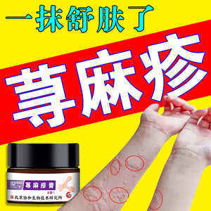 慢性荨麻疹过敏止痒断专用根药膏中成药寒冷性胆碱能性寻麻疹风团