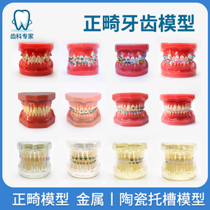 牙模型模具正畸半金属半托槽标准牙模矫正种植修复口腔教学牙模型
