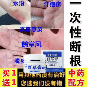 专治鹅掌风汗疱疹手足癣干裂脱皮止痒小水泡真菌感染藓汗疱疹药膏
