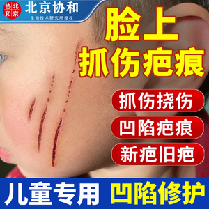 指甲抓伤疤痕祛疤膏儿童专用小孩去疤膏抓痕修复脸部淡疤痕去除06