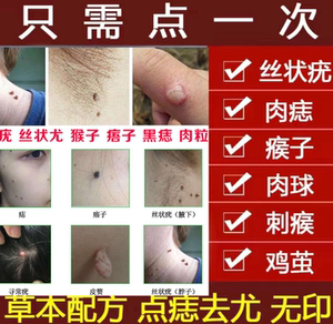 祛痣点痣脸部家用