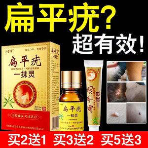 祛除咪喹莫乳膏软疣莎克诺儿童去疣笔治疗扁平疣的药膏丝状疣肉粒