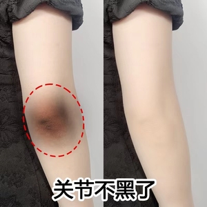 肘部去死皮夏天关节去黑脖子膝盖磨砂膏男儿童磨砂膏身体嫩白全身