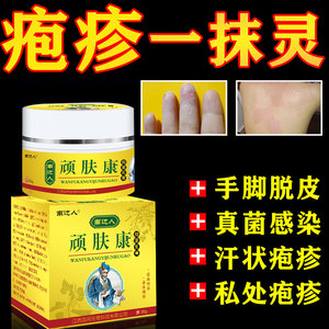 中药草本美肤馆淘宝手癣膏手足癣真菌感染脱皮干裂水泡汗疱疹湿疹