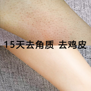 海盐磨砂膏腿部去鸡皮肤疙瘩毛囊角质角化去除神器嫩白全身体乳女