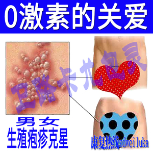 疱疹生殖男女器断外用根净防复发hsv2/hsv1病毒单纯性泡喷剂软膏