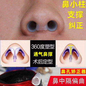 鼻综合隆鼻术后鼻子支撑架塑形定型鼻小柱固定纠正鼻孔矫正扩张器