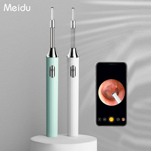 智能可视采耳高清挖耳勺掏耳朵神器带摄像头大人儿童发光采耳工具