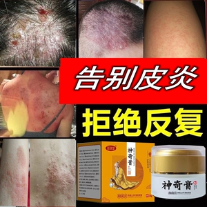 00泰国吉曼淘宝治疗脂溢性毛囊皮炎头皮屑面部去根除头部癣外专用的