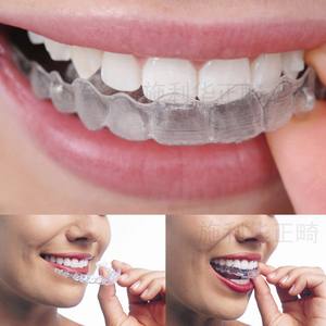 牙齿矫正器定制隐形牙套正畸箍牙外凸龅牙不齐夜磨牙套透明保持器