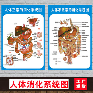 人体不正常消化肠道系统大肠动脉静脉血管器官医学宣传挂图海报