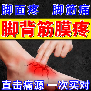 脚背筋膜炎专用药膏脚筋脚面疼痛腱鞘囊肿贴鼓包治疗足背脚底板sj