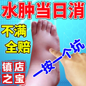 利尿排水肿贴消水肿脸部手肿脚肿消肿的药老人去下肢水肿神器膏茶