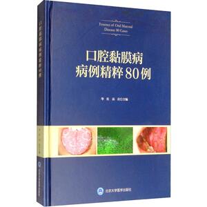 口腔黏膜病病例精粹80例 华红,高岩  生活 五官科 医学其它 新华书店正版图书籍北京大学医学出版社