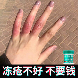 防冻防裂冻疮膏止痒冻伤膏治根正品冻手消肿特效耳朵成人儿童蛇油