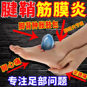 脚背脚踝腱鞘炎囊肿足跟痛足底筋膜炎关节疼痛鼓包贴治疗药kk