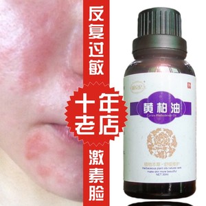 过敏皮肤修复激素