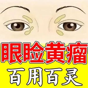去除眼黄瘤睑黄疣药膏眼部祛黄色瘤眼脸黄瘤脂肪粒睑黄瘤元康软膏