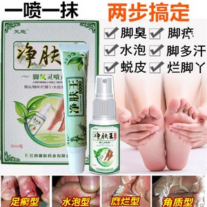 脚癣膏手足癣