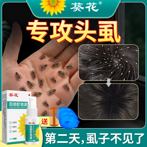 虱子药小女孩头发儿童头虱子百部酊头上长的虱立净去除虱卵灭阴虱